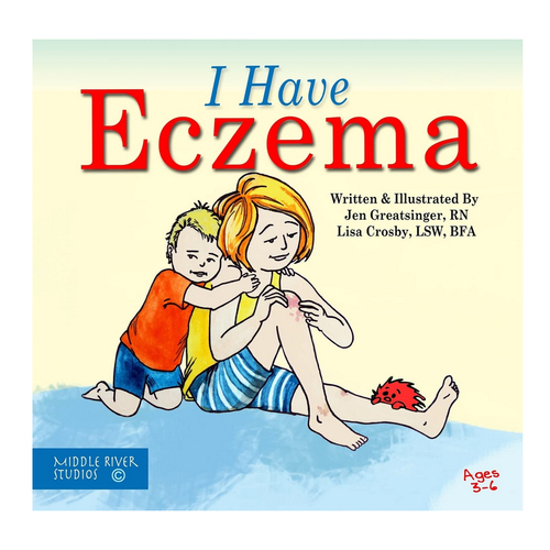 I Have Eczema